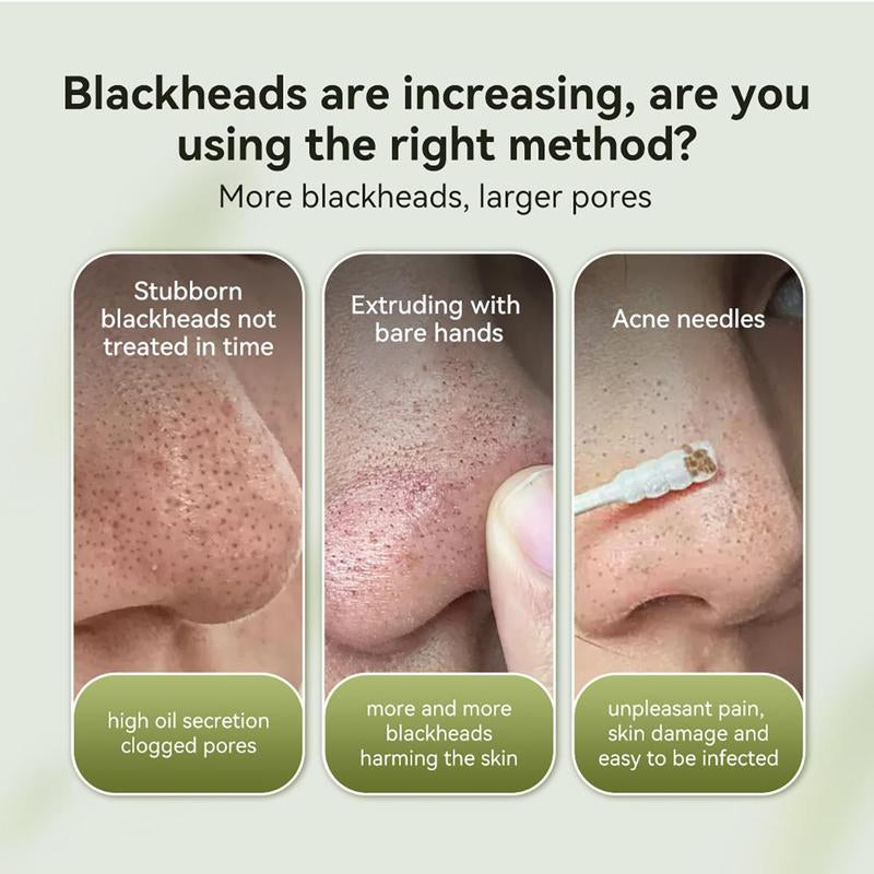 【Top Sellers】Lanbena Blackhead Pore Remover Mask Aloe & Chrysanthemum Extract, Gentle on All Skin Types - Charcoal 2%BHA