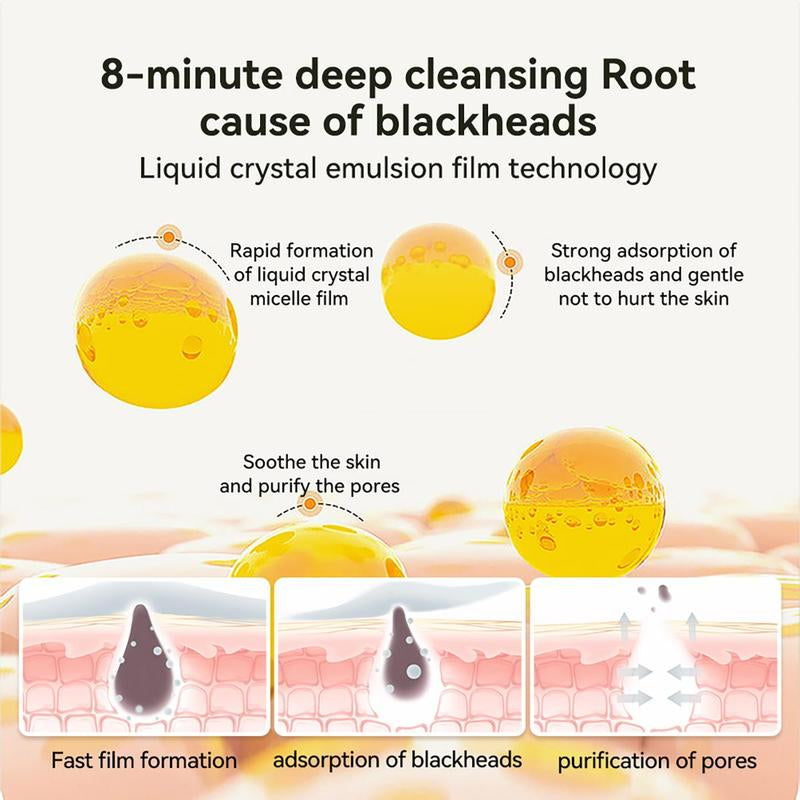 【Top Sellers】Lanbena Blackhead Pore Remover Mask Aloe & Chrysanthemum Extract, Gentle on All Skin Types - Charcoal 2%BHA